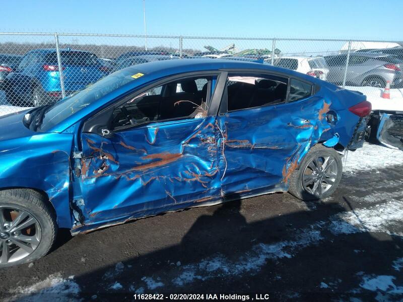 2018 HYUNDAI ELANTRA SEL/VALUE/LIMITED - KMHD84LF9JU698230 | SeoVin.biz